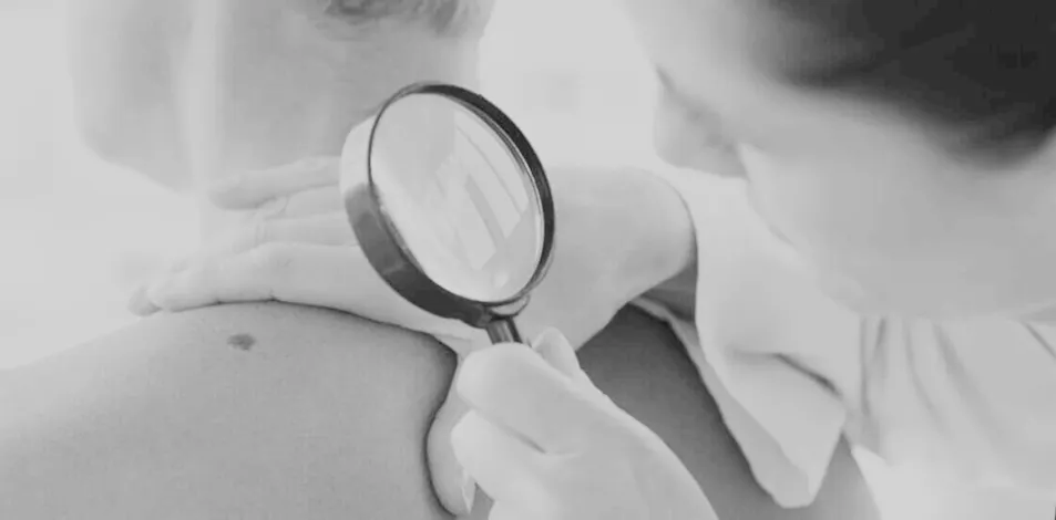 Surgical Lesion Removal