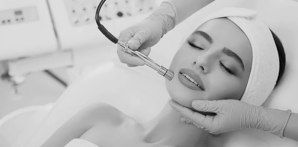london microdermabrasion skin treatment clinic