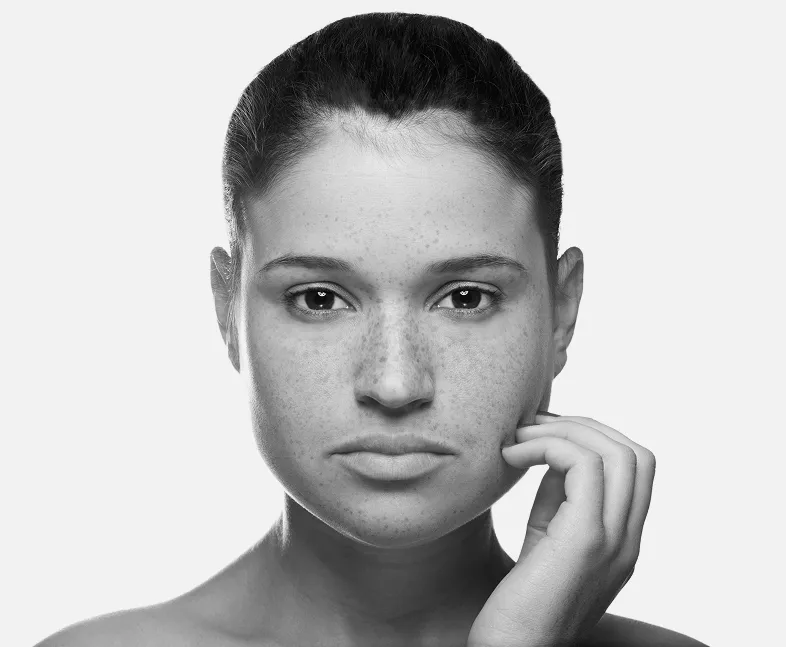 chemical peel mississauga for smoother skin