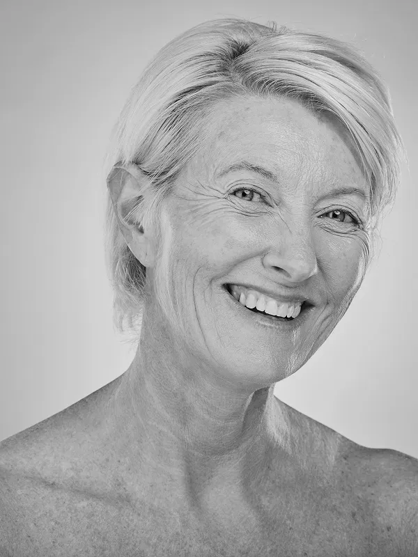 pixel laser mississauga for skin concerns