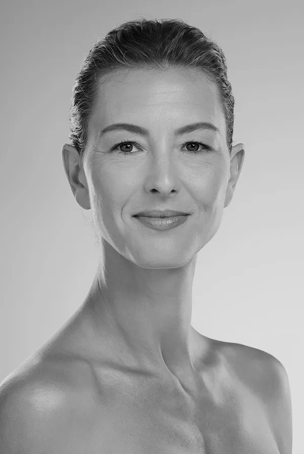 london botox