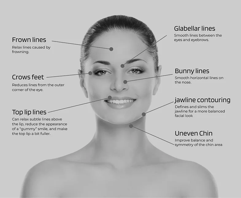 botox treatment in london