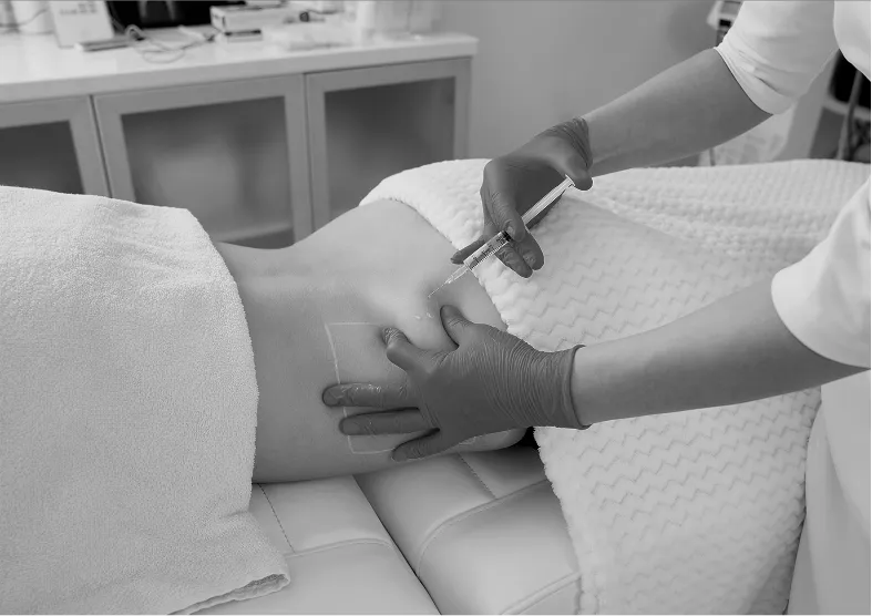 lipodissolve injections in london