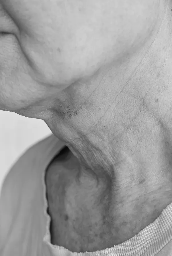 prp treatment in london